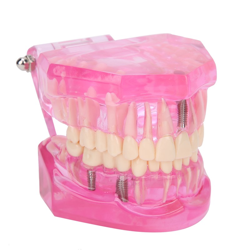 Transparent Adult Teeth Model Pathological Repair Studying Dental Teaching Tools