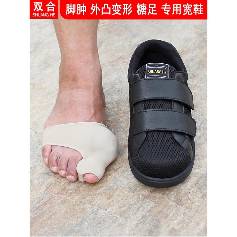 깁스 신발 발가락 발깁스 기브스 발깁스신발 따뜻한 1 보조기 찍찍이