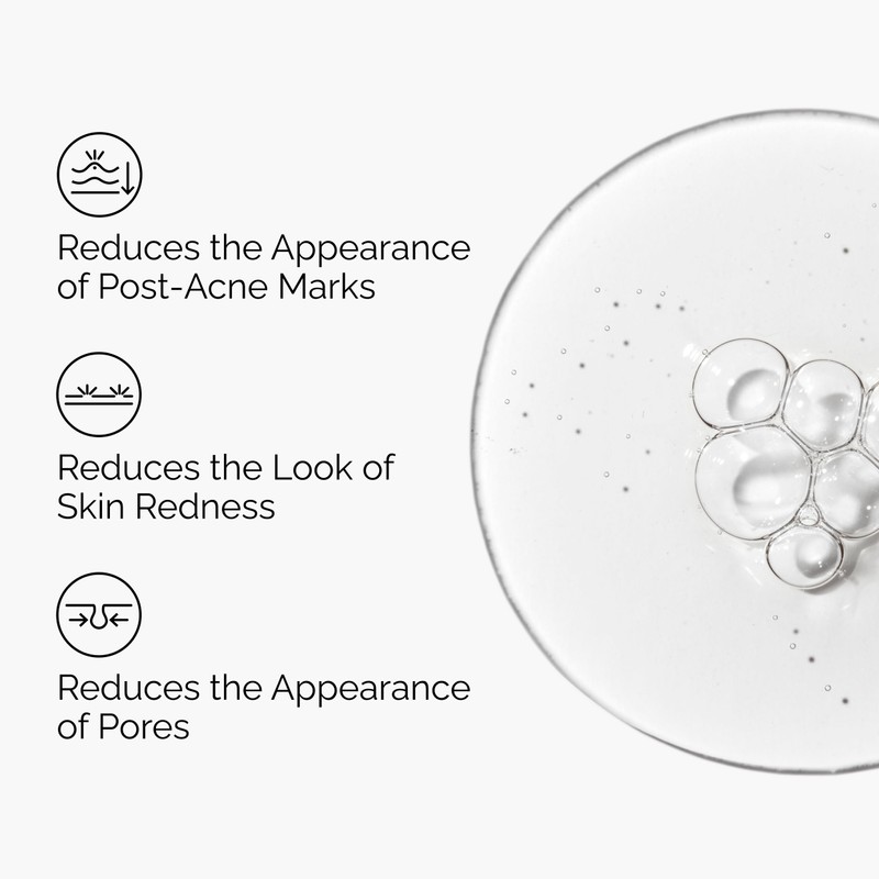 The Ordinary Aloe 2% + NAG 2% Solution, Soothes Skin