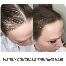 BRIMFULITE Hairline Powder for Women - Instant Root Cover Up, Stain-proof & Windproof Gray Hair Coverage with Compact Puff and Mirror (Dark Brown, 0.14 Oz.)