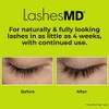 LashesMD Eyelash Growth Serum & Eyelash Conditioner for Naturally Fuller