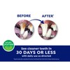 Fresh Dental Dog Toothpaste for Teeth Cleaning, Dog Breath Freshener,