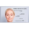 12M Nakery Beauty Rapid Lift Multi Peptide Serum Facelift in