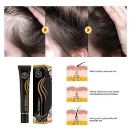 Gzbz Suero Orgánico For El Crecimiento Del Cabello En