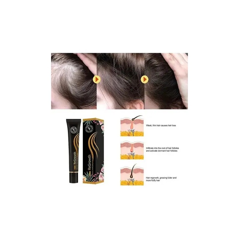 Gzbz Suero Orgánico For El Crecimiento Del Cabello En