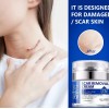 Crema/gel para cicatrices profundas, queloides, cacarizos