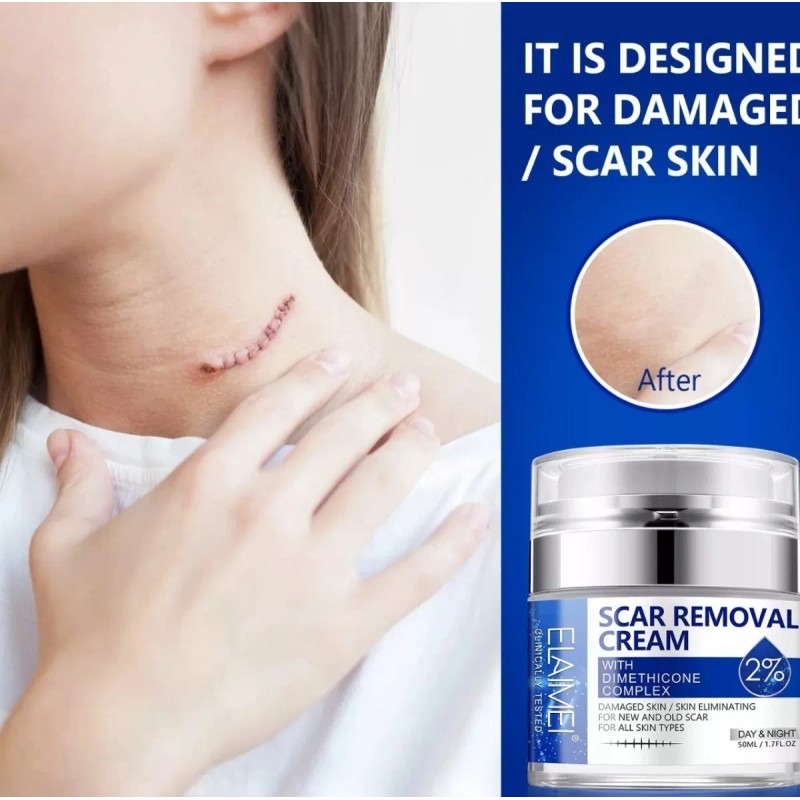 Crema/gel para cicatrices profundas, queloides, cacarizos