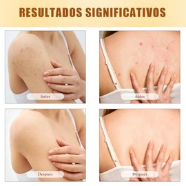 Sebo de Res para la Cara,Sebo de Res Crema Batido con Miel,Crema de Sebo de Res y Miel,Manteca Facial y Corporal para Piel MuySeca. (1)