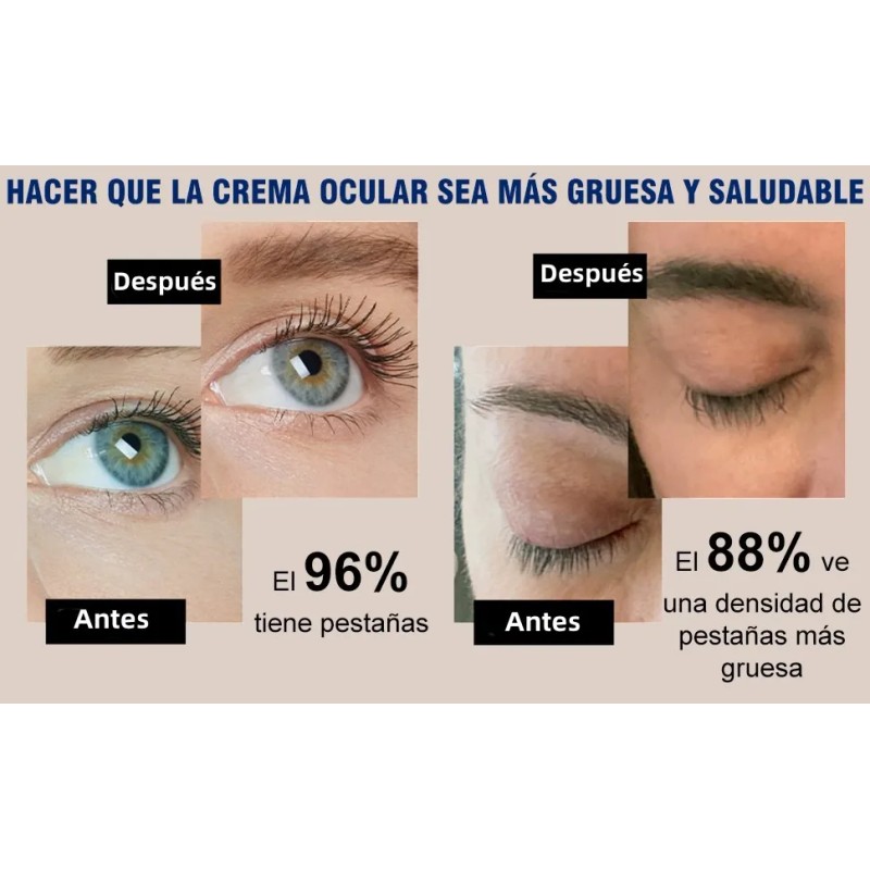 Pestaña Aceite De Ricino, Aceite Para El Crecimiento Cabello