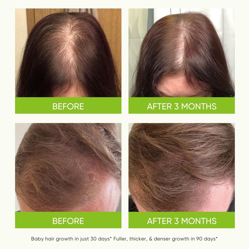 Svvimer Hair Growth Serum Spray - with Rosemary Batana Oil