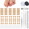 Professional Ingrown Toenail Set Breathable Ingrown Toenail Correction Strips, Curved