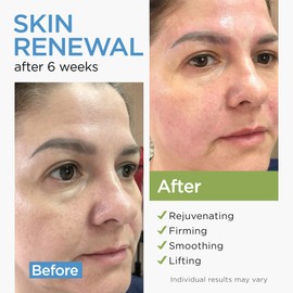 Collagen Face Cream with Stem Cells Retinol Hyaluronic Acid Niacinamide for All Skin Types - Anti-Aging Face Moisturizer with Airless Pump - Day & Night Cream for Wrinkles - Made in USA 1.7 Oz