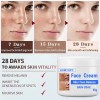 Crema Aclaradora Facial Moteada 50 G, Melasma Speckle Moistu