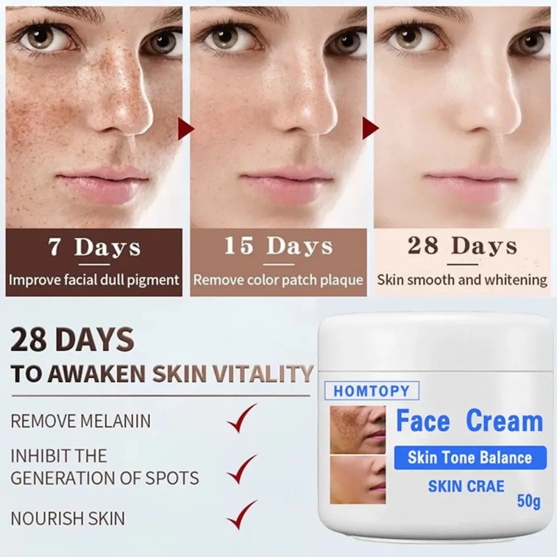 Crema Aclaradora Facial Moteada 50 G, Melasma Speckle Moistu