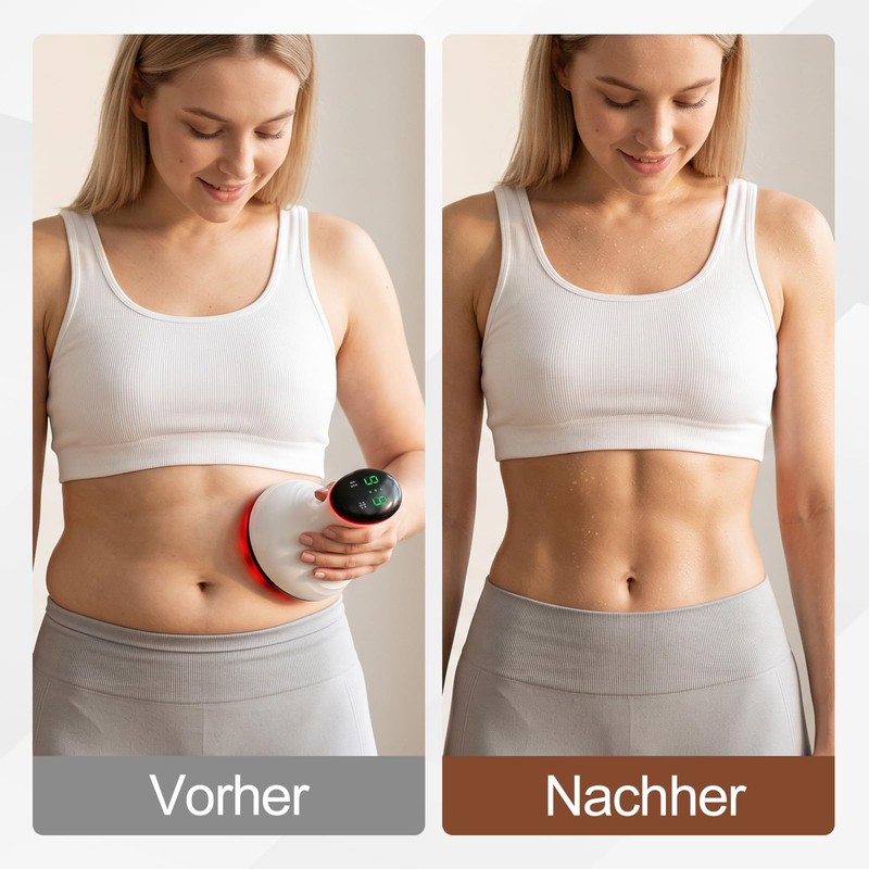 Cellulite Massager Lymphatic Drainage Device Electric Vacuum Cupping