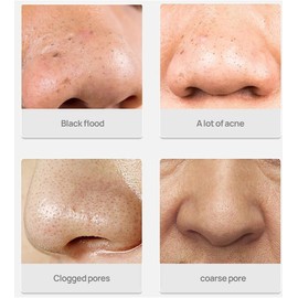 2 unidades Crema Mágica Para Quitar Espinillas y Puntos Negros Con 60 Tiras Removedores, Nariz Tiras Limpieza Poro Remover Espinilla Eliminación Pelar Nariz Tiras Nose Pore Strips