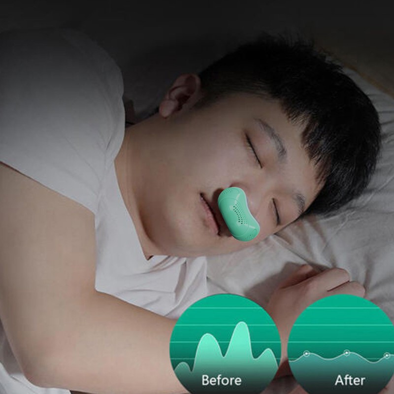 Electric Snoring Device Solution Home Travel Portable Ergonomic Men Women