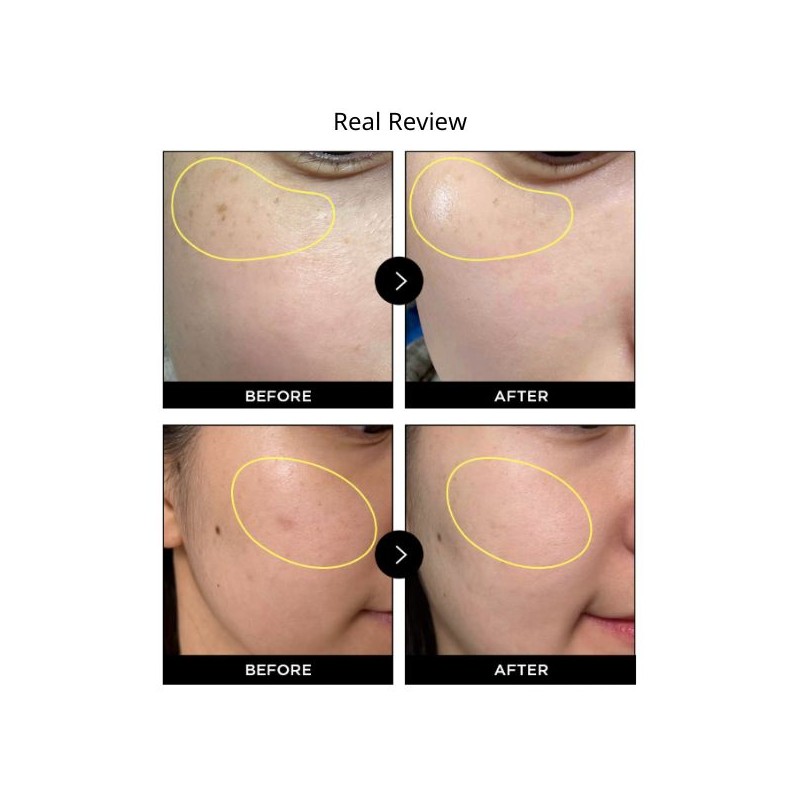 ATHE Melaser Programming Amoule For Melanin Care 10ml*2ea(For 2weeks Routine)