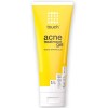 Touch Benzoyl Peroxide 2.5% Tratamiento Contra Acné En Gel
