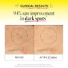 DERMA E Vitamin C Renewing Moisturizer with Probiotics and Rooibos,