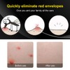Antipruritic Stick Portable Mosquito Insect Bite Anti Itching Pen for