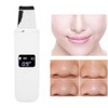 Ultrasonic Face Skin Scrubber Facial Cleanser Exfoliating Remove Blackheads Pimples