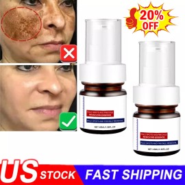 Unbranded USA Whiting And Freckle Removing Serum Cream Dark Spot Removing Freckle Essence - 1pcs-Face Essence