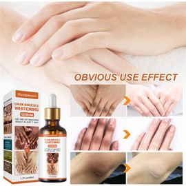 Serum Oil Skin Glow To Lightening Acne Dark Patches Acne Bright Skin Dark Spot Corrector Face Whitening Serum Dark Spot Corrector Serum (3 PCS)