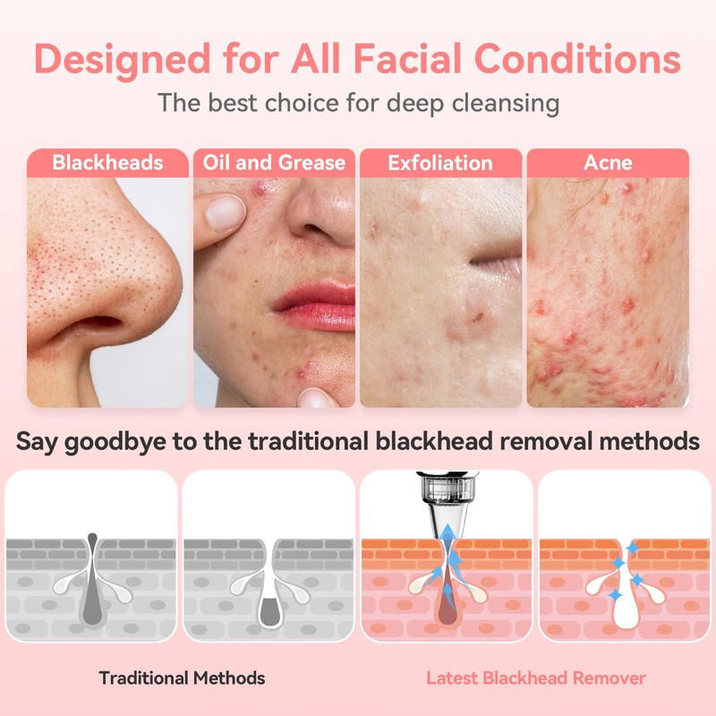 Blackhead Remover Pore Vacuum Upgraded Facial Pore Cleaner Electric Comedone