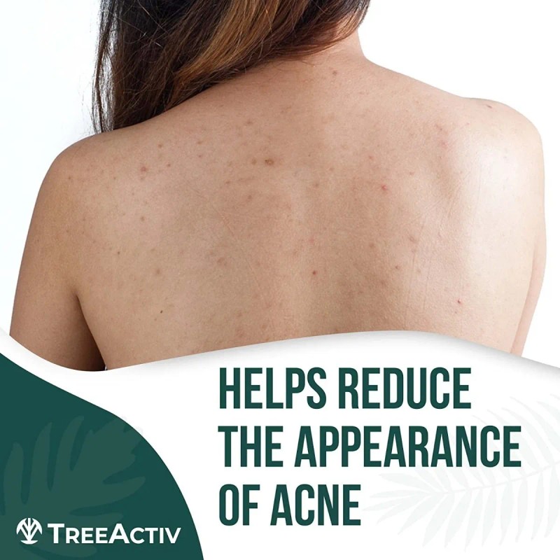 Treeactiv Gel Corporal Exfoliante Para Acné Espalda Glúteos