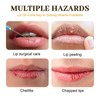 Fast Lightening Pink Mouth Lips Serum Bleaching Permanent Remove Dark