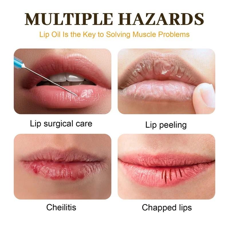 Fast Lightening Pink Mouth Lips Serum Bleaching Permanent Remove Dark