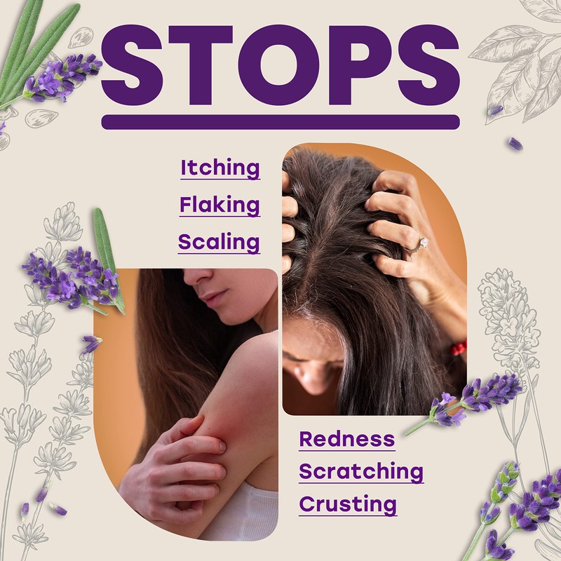 Three (3) Bars of Candida Freedom Probiotic Lavender Soap 4