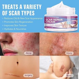 Crema Cicatrices 50g Reparadora Piel, Cirugías, Acné y Quemaduras Hidratante Regeneradora, Anti Manchas, Reductor Marcas Antiguas y Nuevas