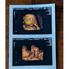 Prank 3D COLOR Customized Fake Ultrasound Strip of 2 Photos