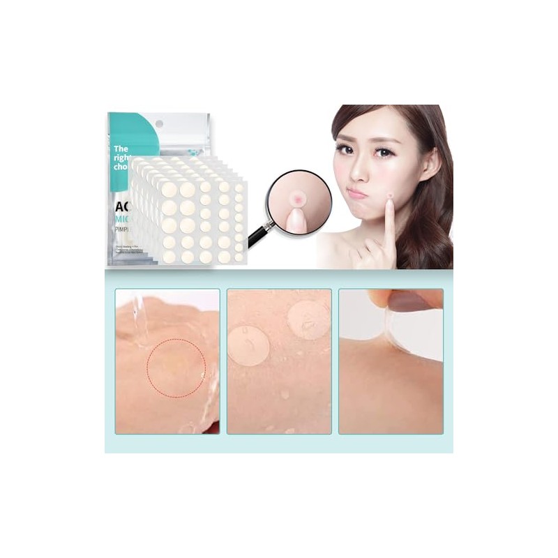 スポットパッチ CICAパッチ 敏感肌 肌荒れスキンケア 毛穴ケア シ アクネパッチ大容量 昼用+夜用 スキンケア部分パック ニキピパッチ