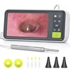 Anykit Digital Otoscope with Gyroscope, 4.5 Inches Screen, 3.9mm Ear