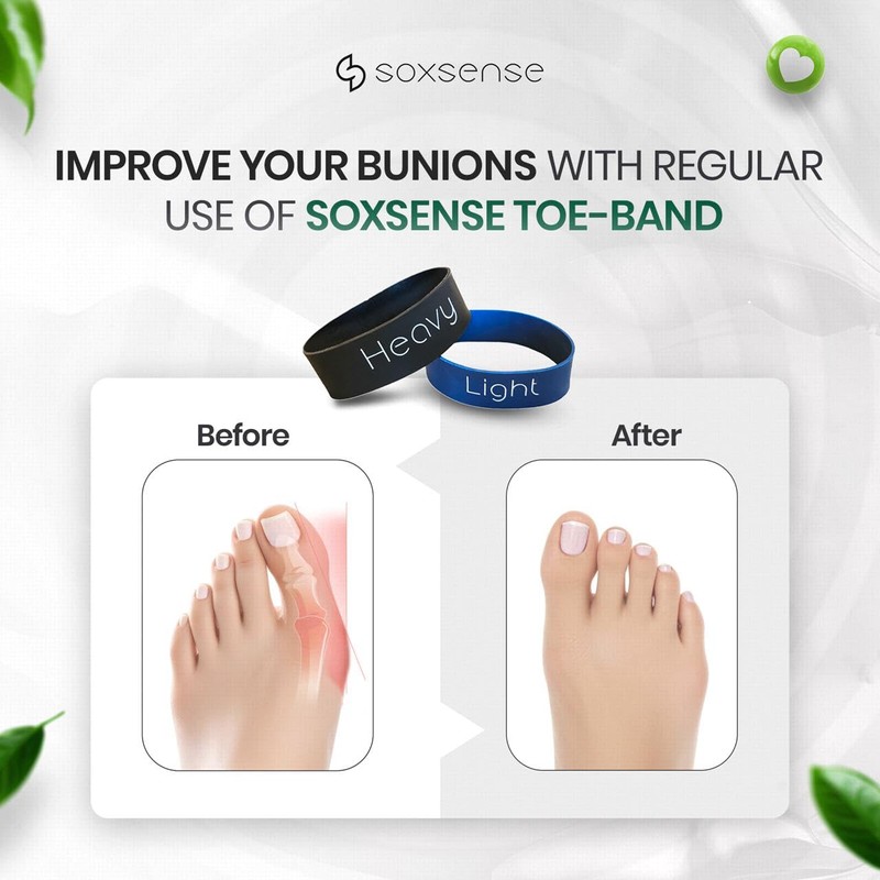 Soxsense Toe Stretcher Bands - Toe Spacers for Bunion Correction,