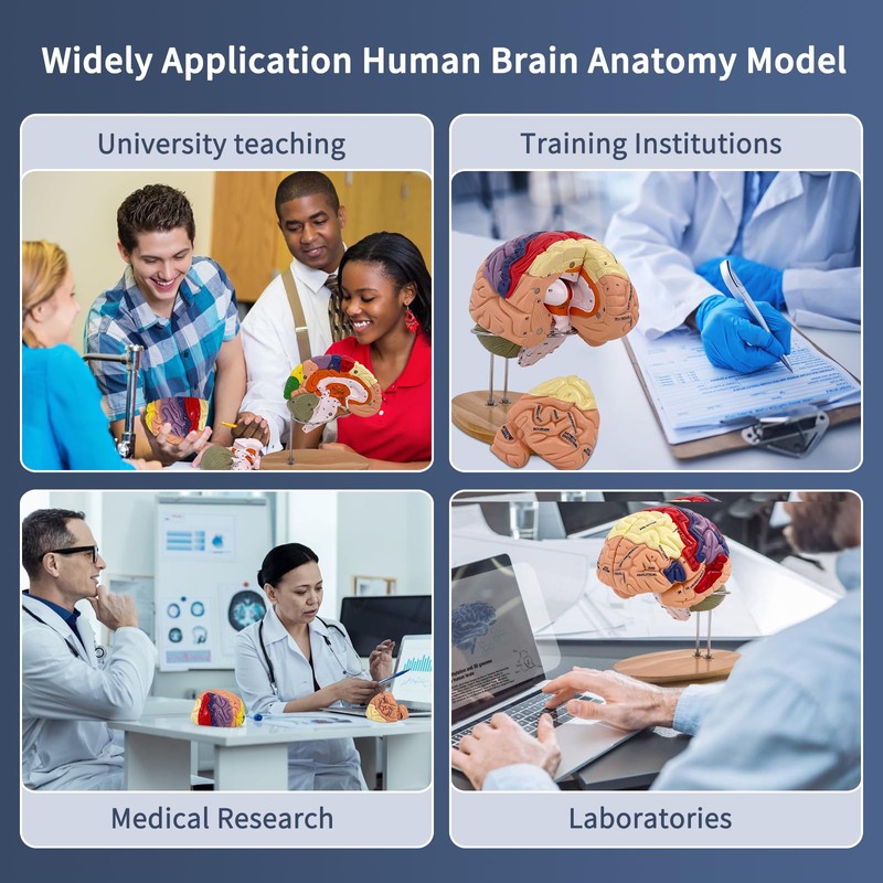 SFXYJ Human Brain Model 2 Times Life Size,Brain Anatomy Model,