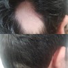 Shampoo Reviving Farmasi /con Ajo , Capixyl Y Trichogen