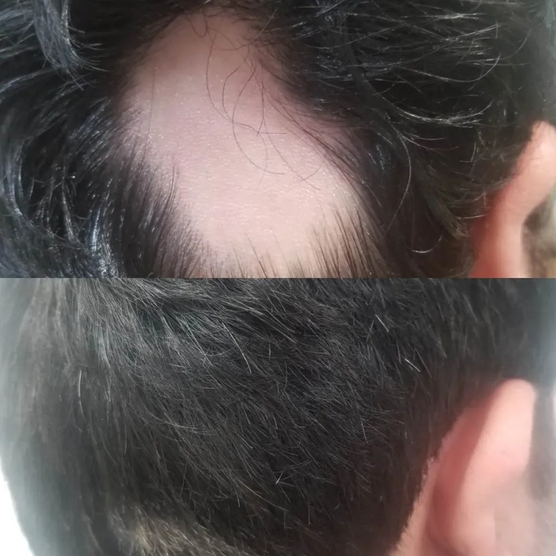 Shampoo Reviving Farmasi /con Ajo , Capixyl Y Trichogen
