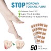 50 Piezas de Parche para Uñas Encarnadas – Soporte Natural