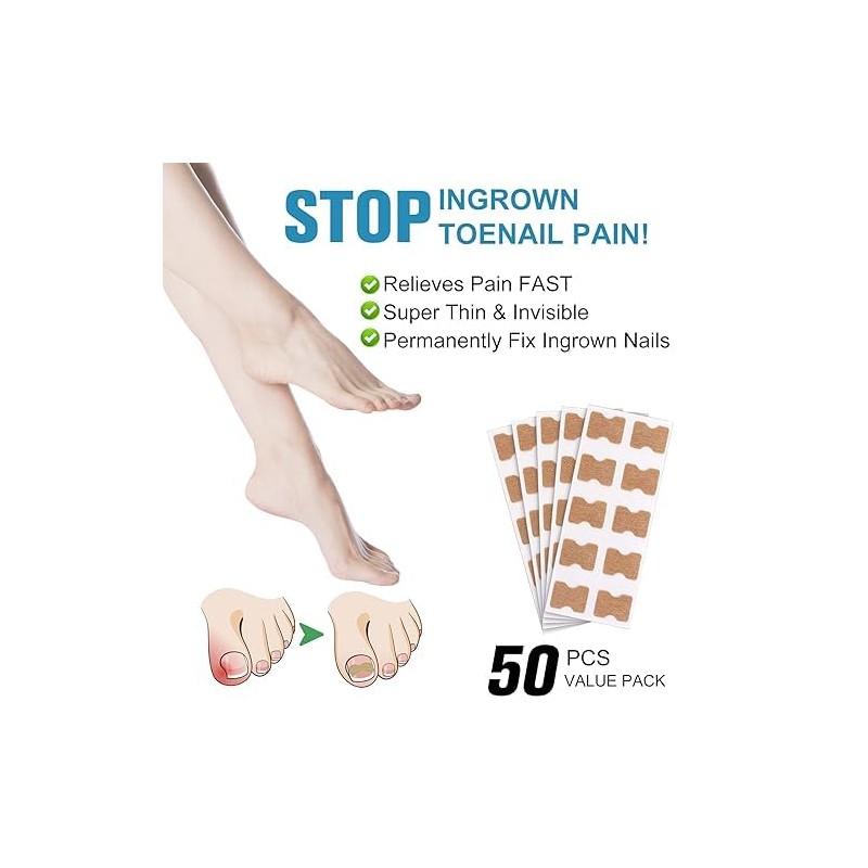 50 Piezas de Parche para Uñas Encarnadas – Soporte Natural