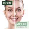 Chrislie Mesaurable Difference Face And Jojoba Body Oil