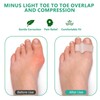 12 Pcs Bunion Toe Corrector,Toe Separators with 2 Loops,Overlapping Toe,Reduce