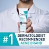 Limpiador Crema Espumosa Acné Cerave Jabón Facial Tratamiento Peróxido Benzoilo