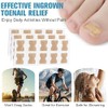 50 Piezas de Parche para Uñas Encarnadas – Soporte Natural