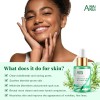 Aceite Facial Acne Anai Rui De Arbol De Te Acido
