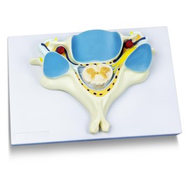 EVOTECH SCIENTIFIC Enlarged Human Fifth Section Cervical Vertebra Anatomical Model with Spinal Cord, 7X Enlarged Transection Cervical Vertebra Model for Medical Learning Research Education Display