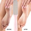 Probelle Probelle Double Sided Multidirectional Nickel Foot File Callus Remover
